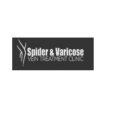 Spider and Varicose Vein Treatment Clinic